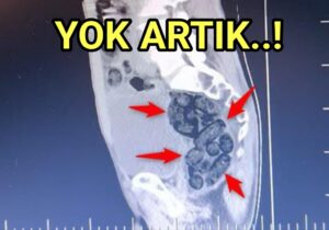 Otobüste Metamfetamin Operasyonu: 1 Tutuklama