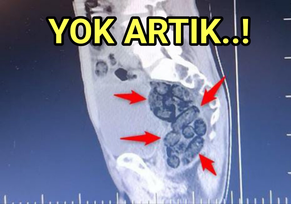 Otobüste Metamfetamin Operasyonu: 1 Tutuklama