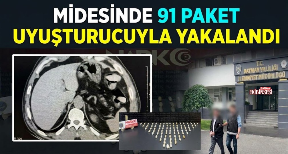 Otobüste Yakalandı: Midesine 91 Paket Uyuşturucu Çıktı